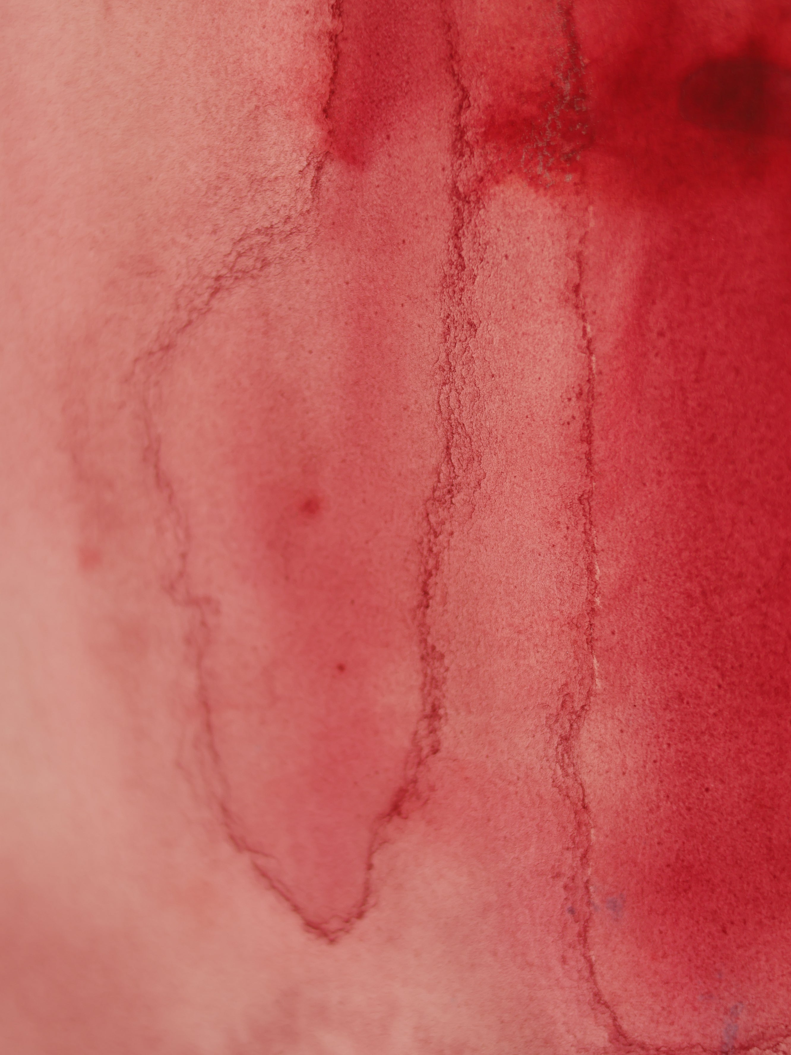 Abstract 28