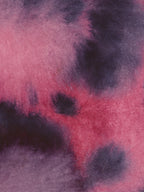 Abstract 38