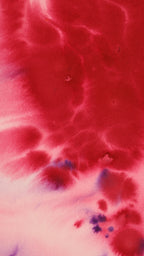 Abstract 49